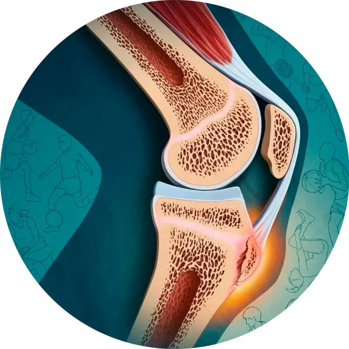 Struktura kloubu a okolních tkání