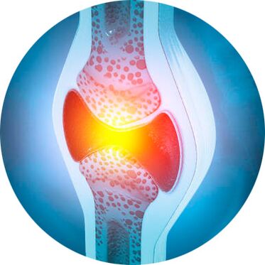 proces obnovy kloubů pomocí gelu Icexin