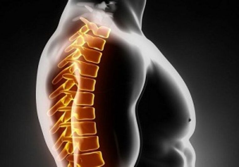 Hrudní osteochondróza doprovází bolest a nepohodlí uprostřed zad